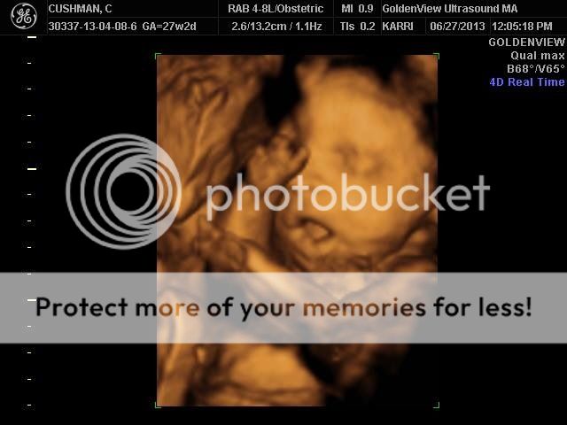 Had to share! 3d/4d ultrasound - BabyCenter